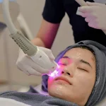 Proses Mempermak Wajah Dengan Laser Kecantikan