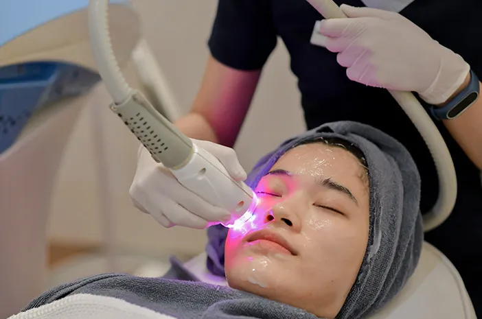 Proses Mempermak Wajah Dengan Laser Kecantikan