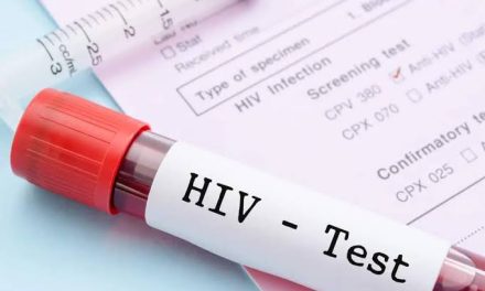 Penyakit Viral HIV Terhadap Banyak Kalangan Usia
