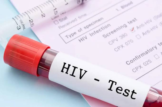 Penyakit Viral HIV Terhadap Banyak Kalangan Usia