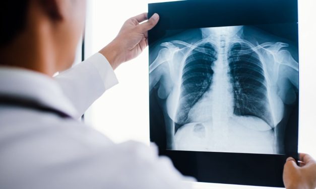 Pemeriksaan Medis Rontgen Dengan Peralatan Canggih